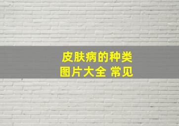 皮肤病的种类图片大全 常见